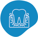 General Dentistrygum Disease